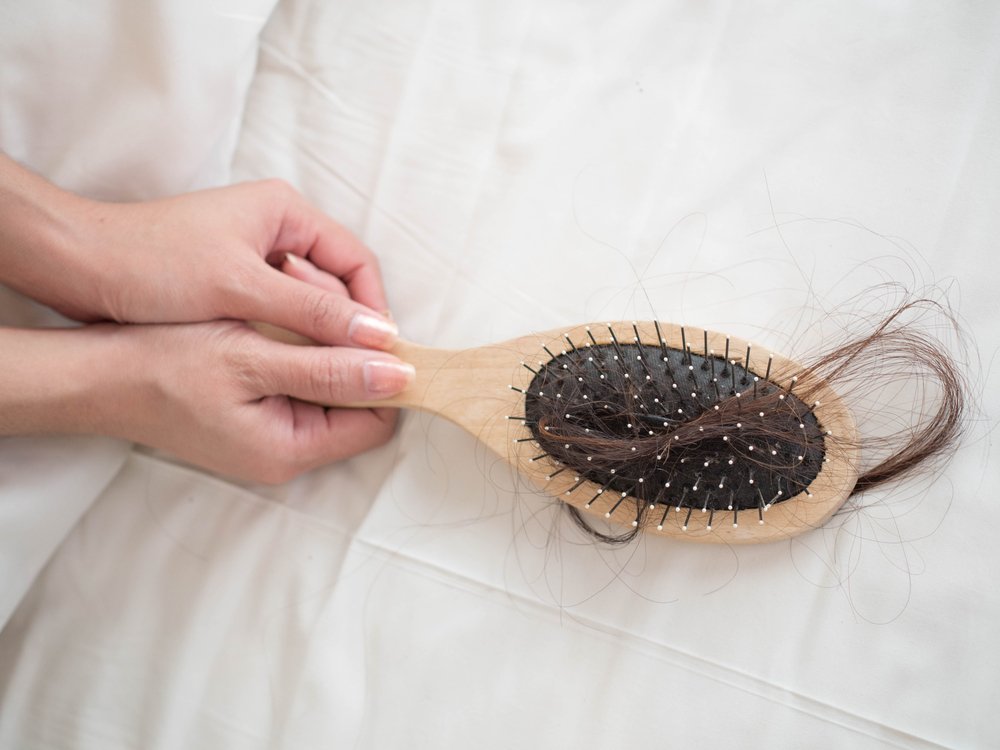 Une perte de cheveux en illustration. | Photo : Shutterstock