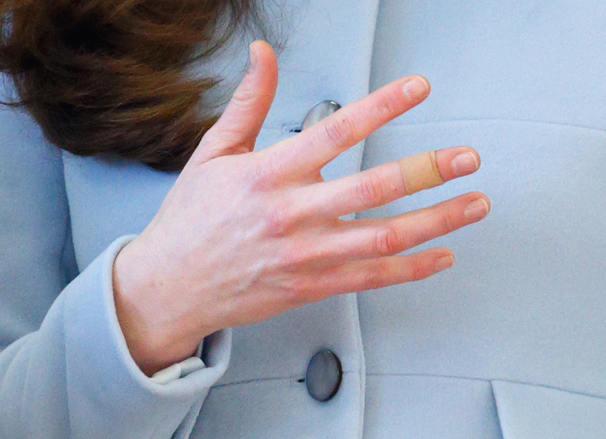 A close-up of Princess Catherine's bandaged finger during her visit to Kensington Aldridge Academy in London, England on January 19, 2015 | Source: Getty Images