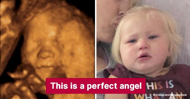 Ultrasound picture of baby boy shows an 'angel' image of his dead sister