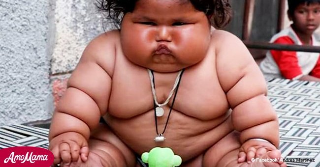 Obese baby girl Chahat Kumar's weight alarms doctors