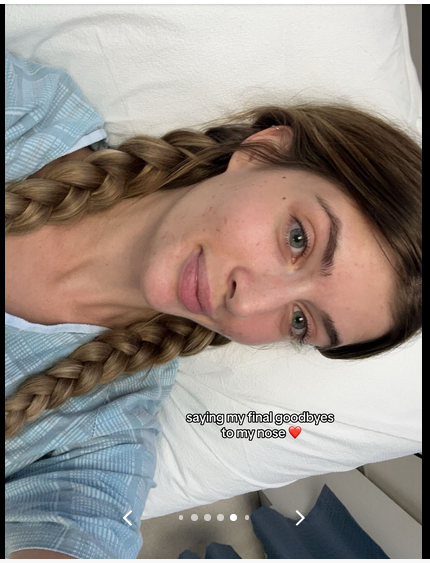 Sami Sheen shares her experience getting a nose job done, on a TikTok post dated August 13, 2024 | Source: Tiktok/@samisheen