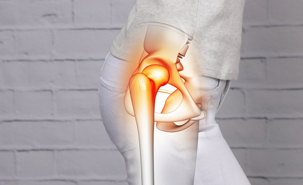 Anatomía de la cadera de una mujer. Fuente: Shutterstock