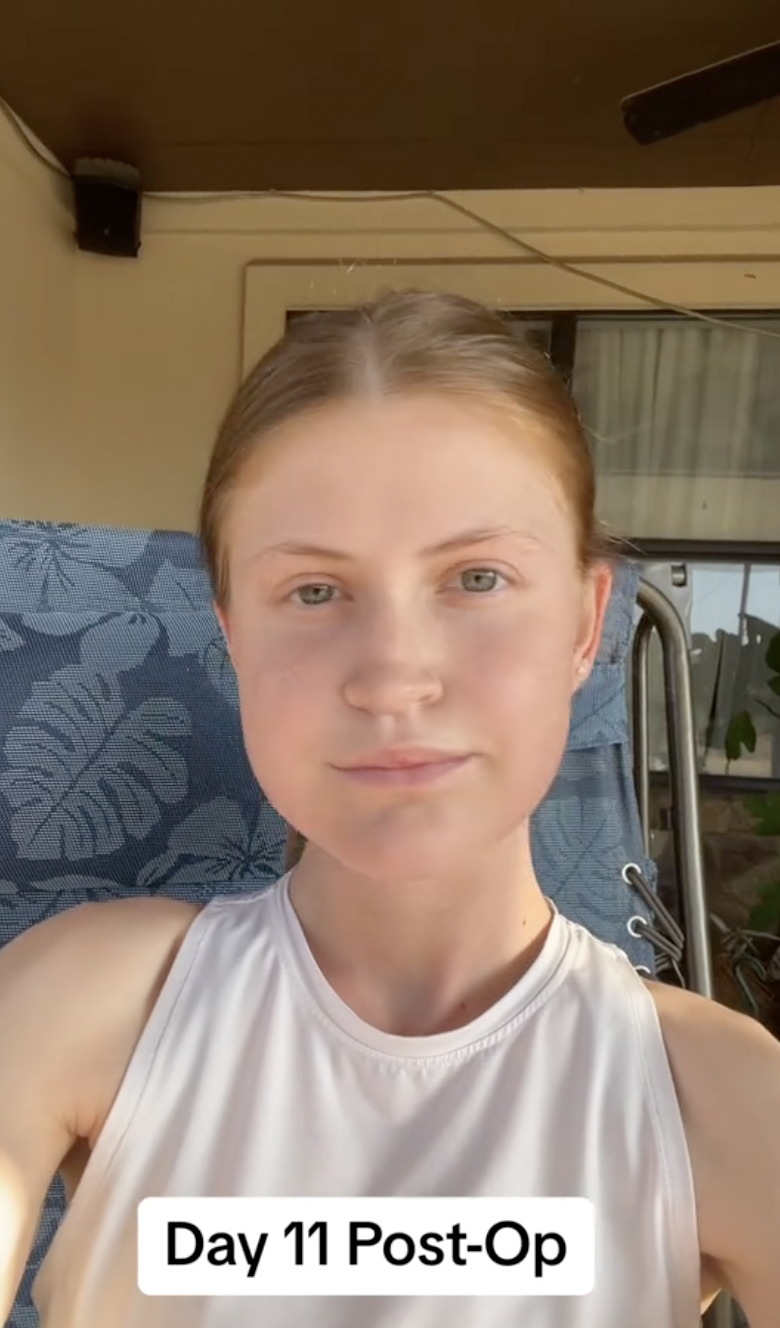 Virginia Elder appears outdoors on Day 11 post-op, framed by sunlight and a steady gaze. | Source: TikTok/virginiaeelder