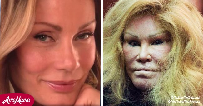 Jocelyn Wildenstein La Femme Chat Declare Banqueroute Elle A Perdu Ses Millions