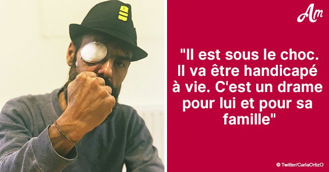 C'est un abattage dans les règles de l'art : Jérôme Rodrigues, blessé à l'œil, témoigne
