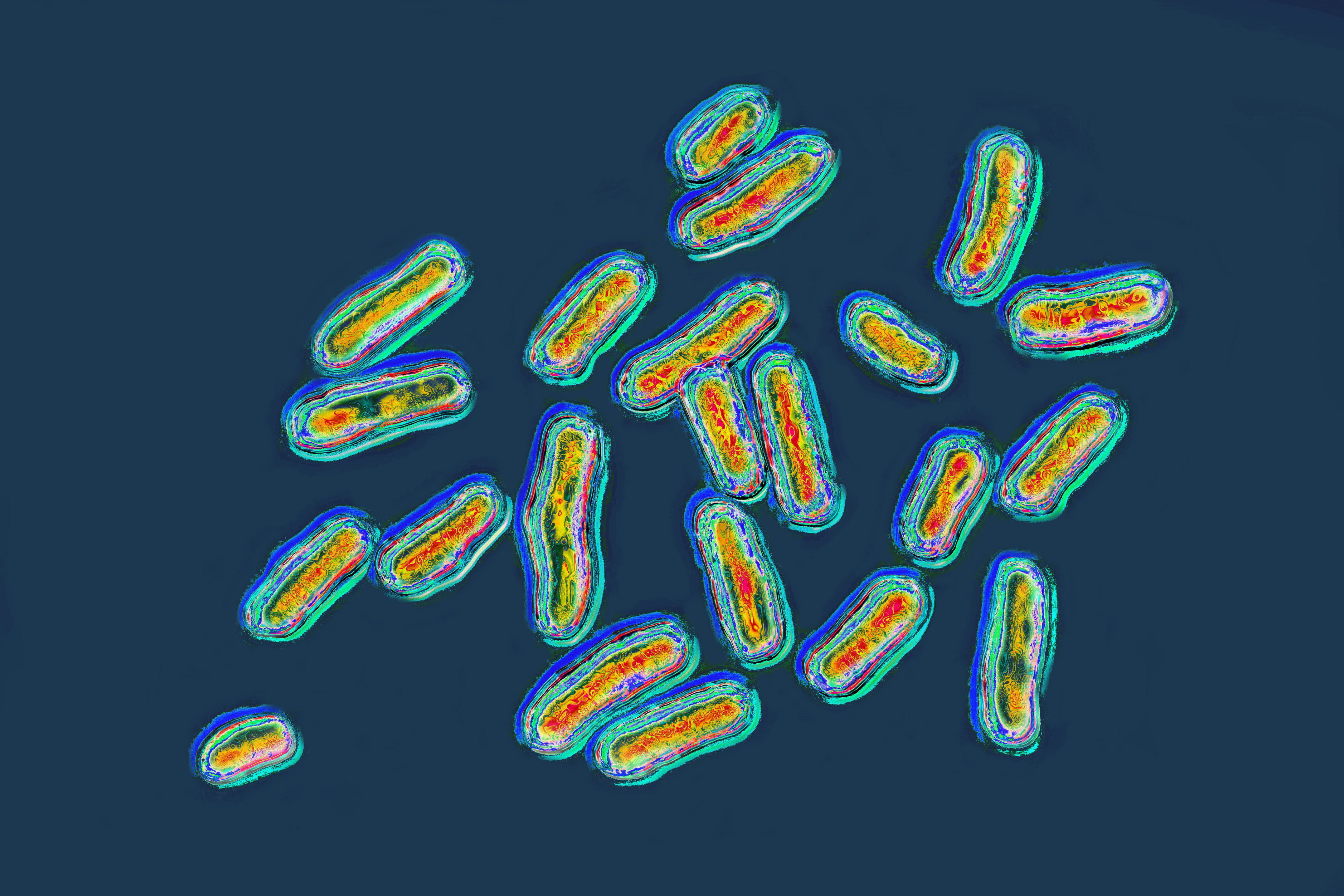 Salmonella's image produced from optical microscopy, dated September 21, 2023 | Source: Getty Images