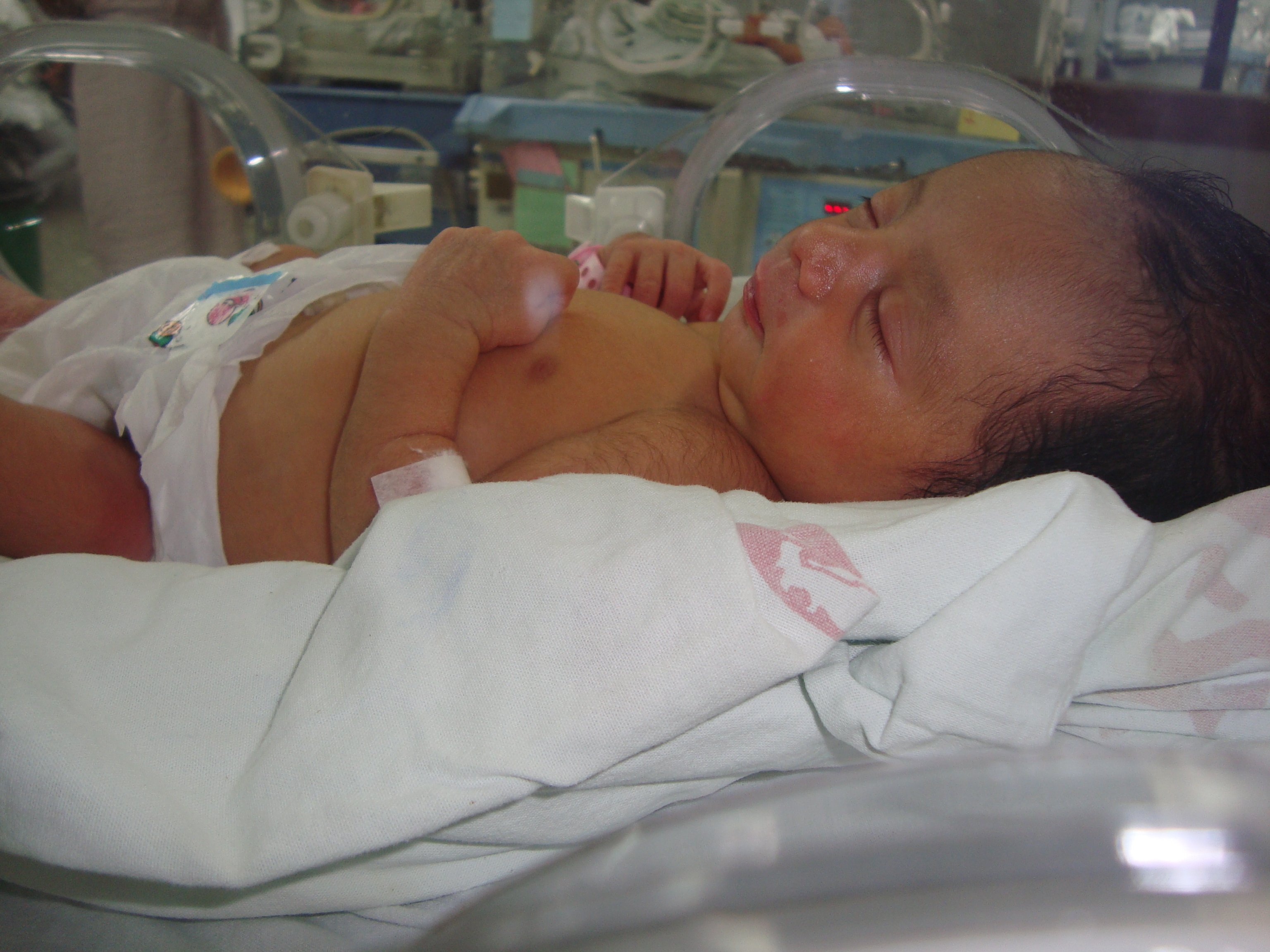 Bebé en un hospital. | Foto: Wikipedia