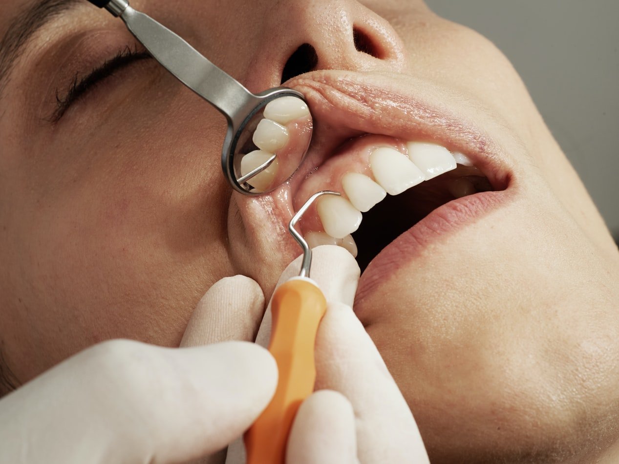 Une personne chez le dentiste. l Source : Unsplash