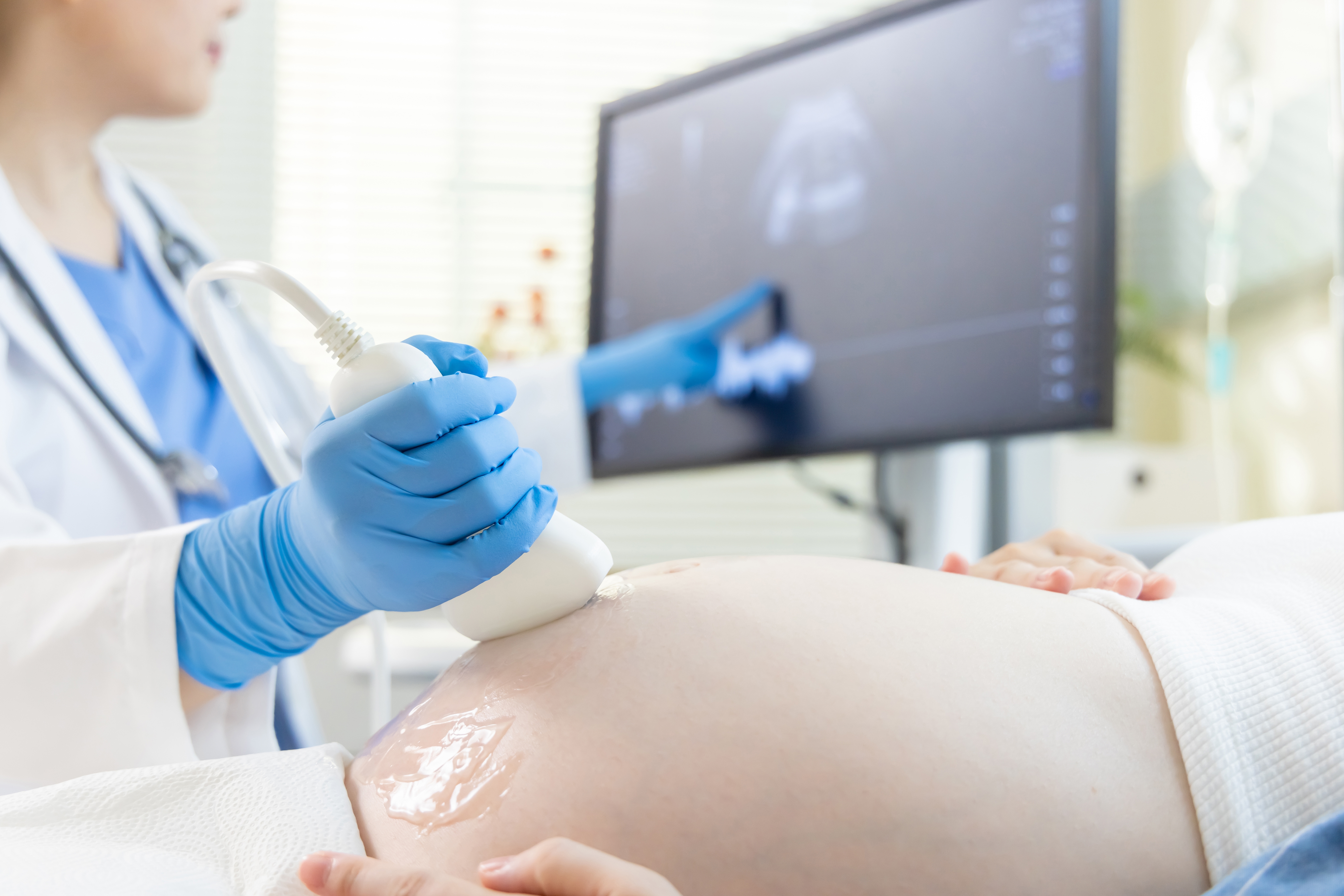 A pregnant woman getting her ultrasound done | Source: Shutterstock