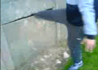 Screenshot of boy's leg stuck in concrete fence. | Source: Reddit