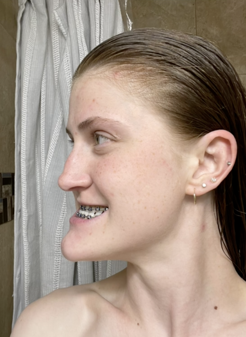 Virginia Elder's unfiltered side profile shows the shape of her jaw and underbite. | Source: Instagram/virginiaelder