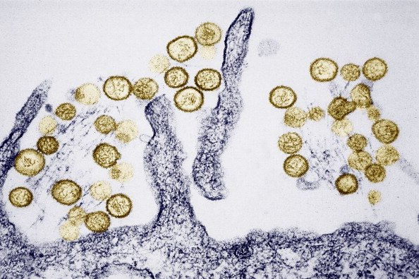Transmission Electron Micrograph Of The Sin Nombre Hanta Virus. | Photo: Getty Images