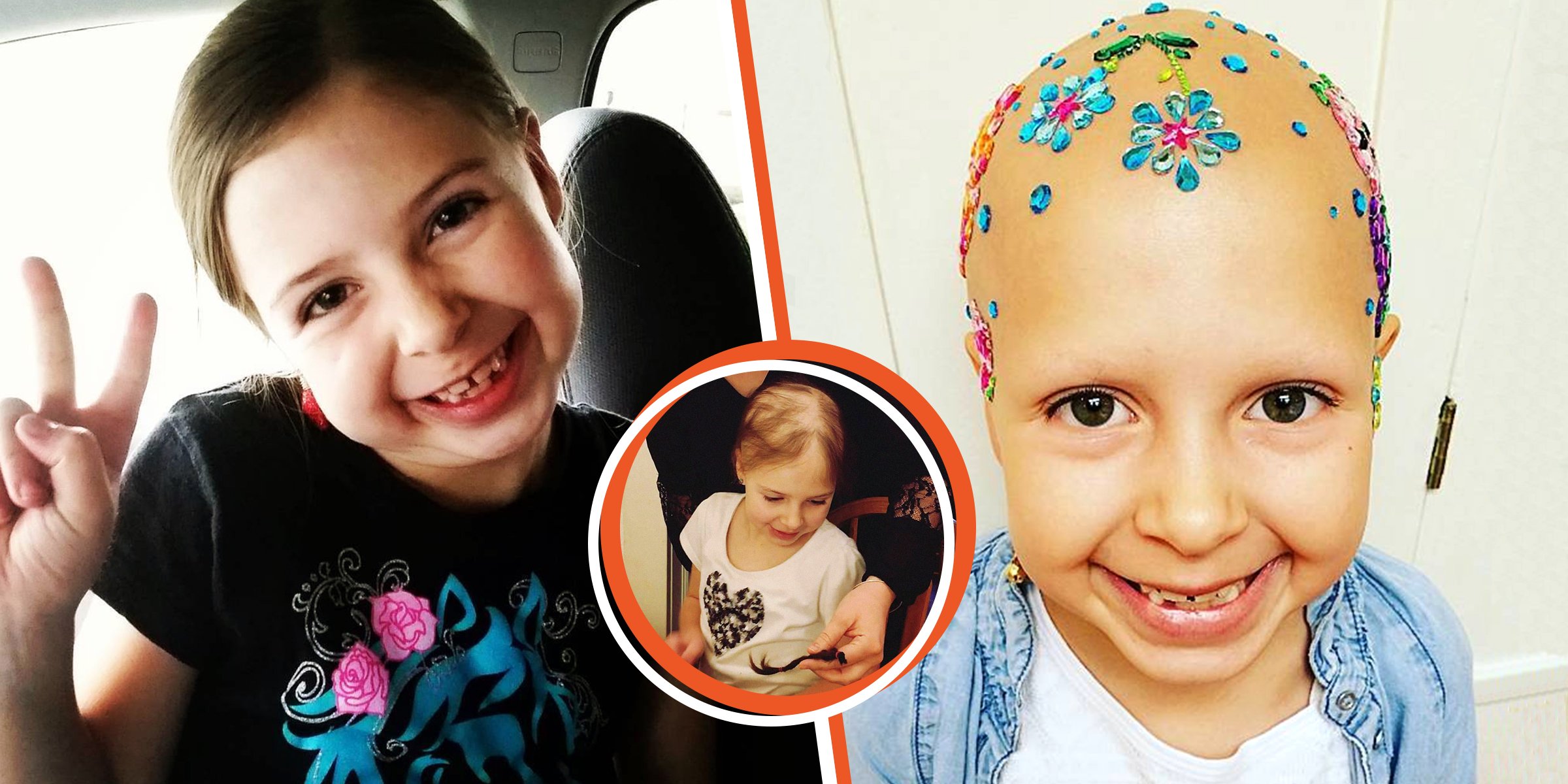 Gianessa Wride | Gianessa con parches sin cabello | Gianessa con adornos brillantes en la cabeza | Foto: instagram.com/daniellawride