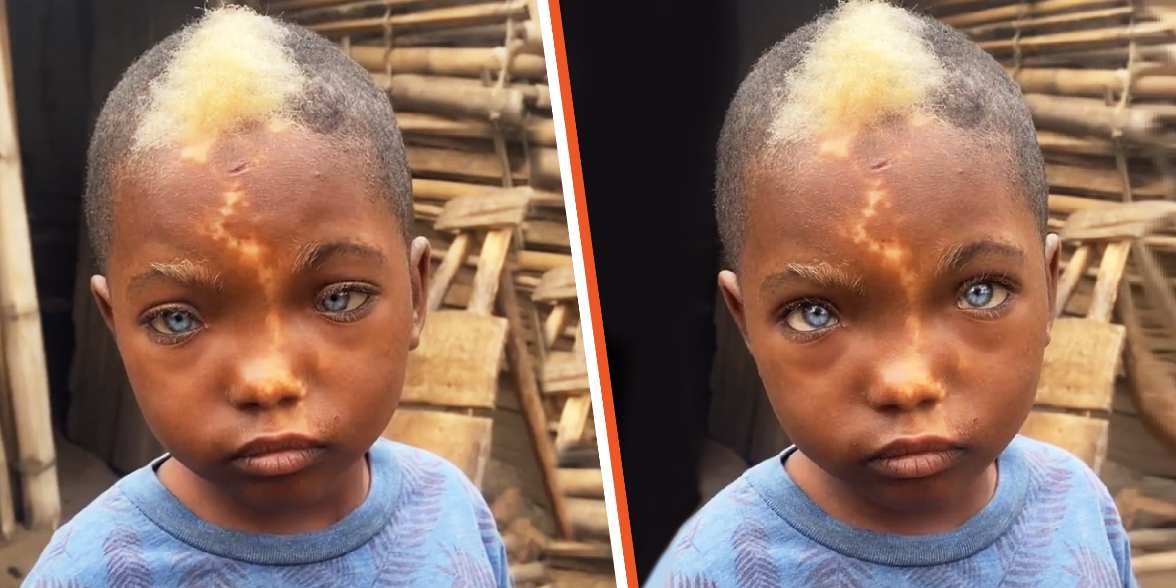 Ein kleiner schwarzer Junge mit einem weißen Haarbüschel, einem blitzenden Muttermal und blauen Augen | Quelle: tiktok.com/raoultsasa0