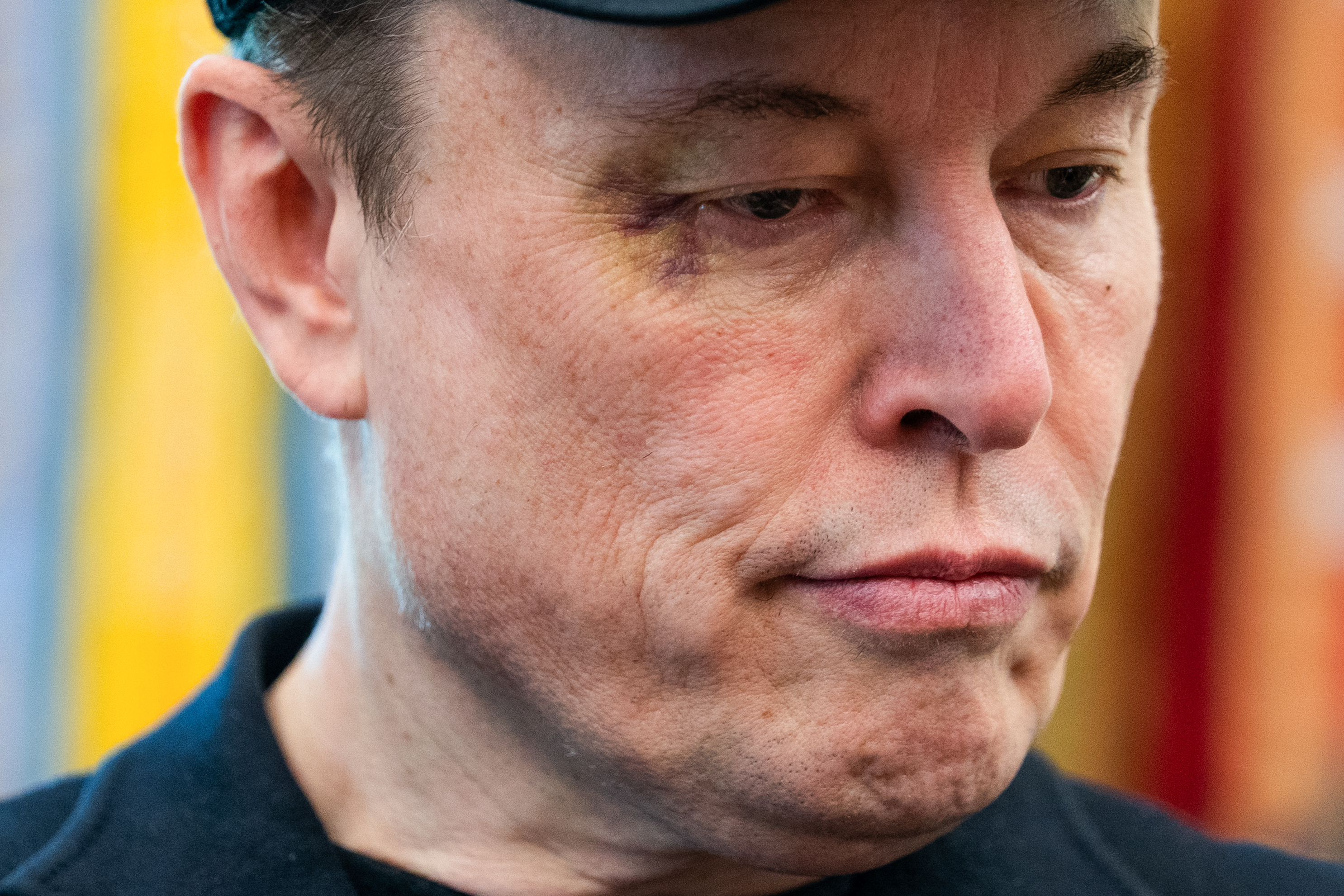 Elon Musk looks on during a news conference with U.S. President Donald Trump in the Oval Office of the White House in Washington, D.C., on May 30, 2025. Musk, sporting a curious black eye, later explained that he received the bruise while playfully roughhousing with his five-year-old son, X Æ A-12.