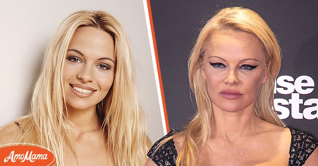(L) A portrait of Pamela Anderson, May 24, 1993. (R) Pamela Anderson during the 'Danse Avec Les Stars' photocall at TF1 TV studios on September 11, 2018 in Paris, France. | Source: Getty Images