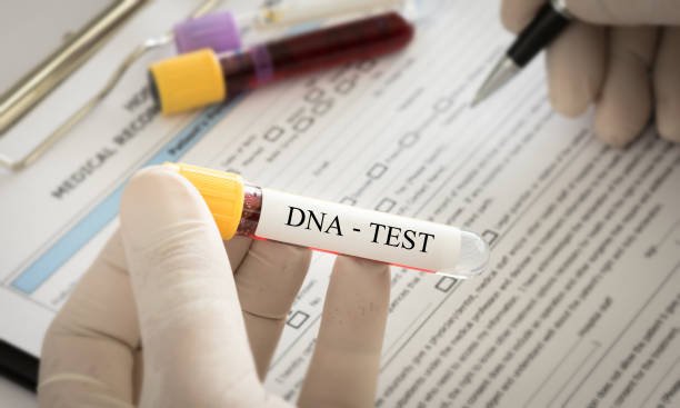 Ein DNA-Test. | Quelle: Pexels