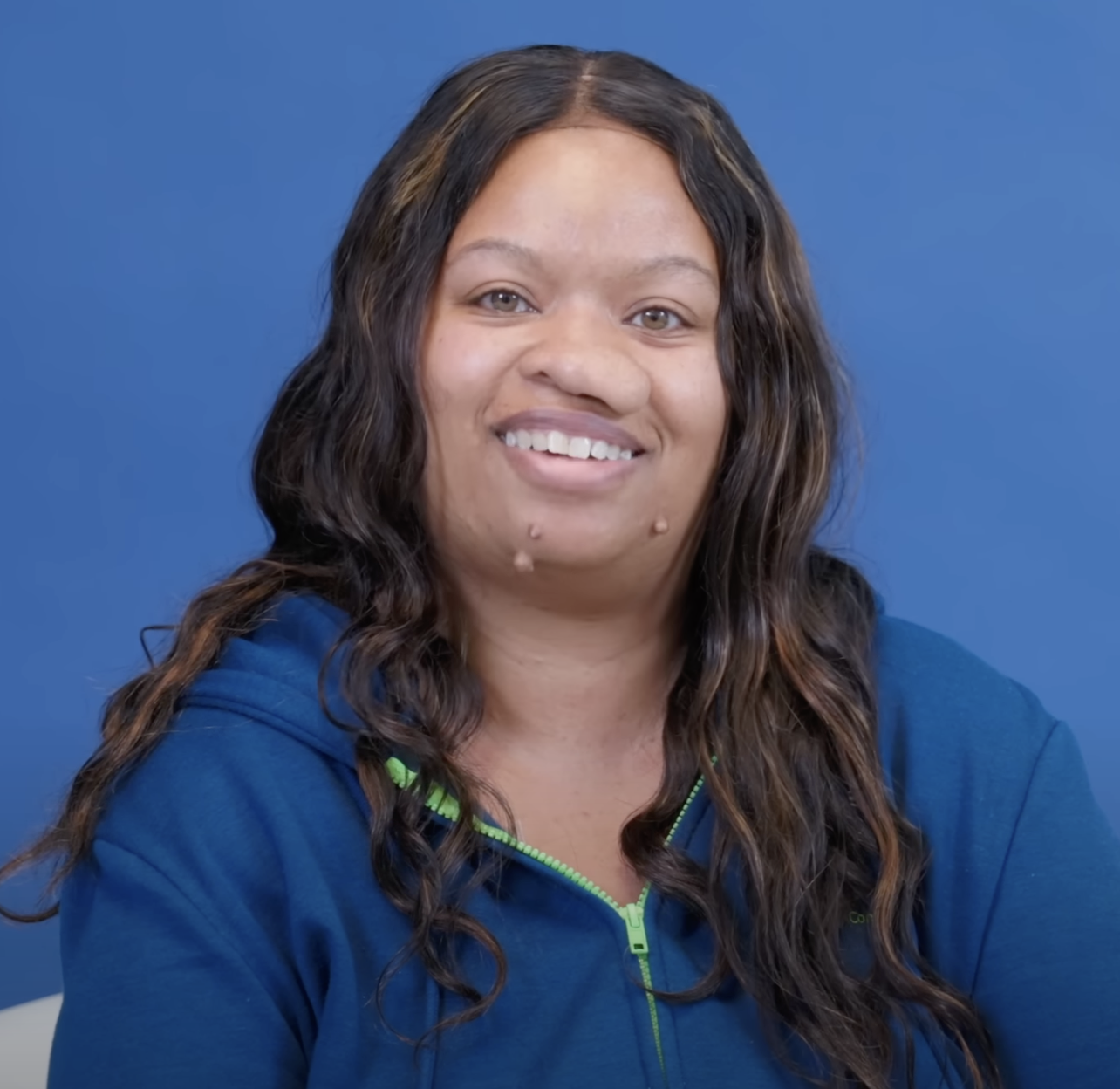 Danielle before her life-changing surgery, dated August 2, 2024 | Source: YouTube/@Dr.Truesdale