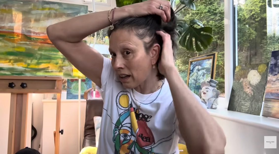A brave reveal captured in her April video, as Sykes lifts her hair to expose the effects of alopecia. With unwavering honesty, she describes the toll of her illness — both physical and emotional — in a moment as heartbreaking as it is courageous. | Source: YouTube/Melanie Sykes Is.