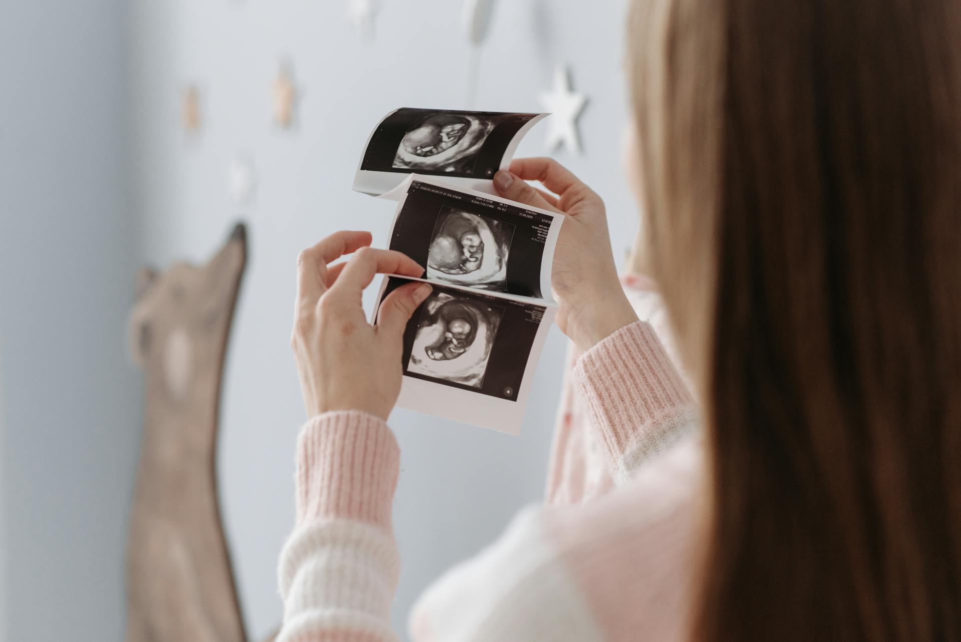 A woman holding an ultrasound image | Source: Pexels