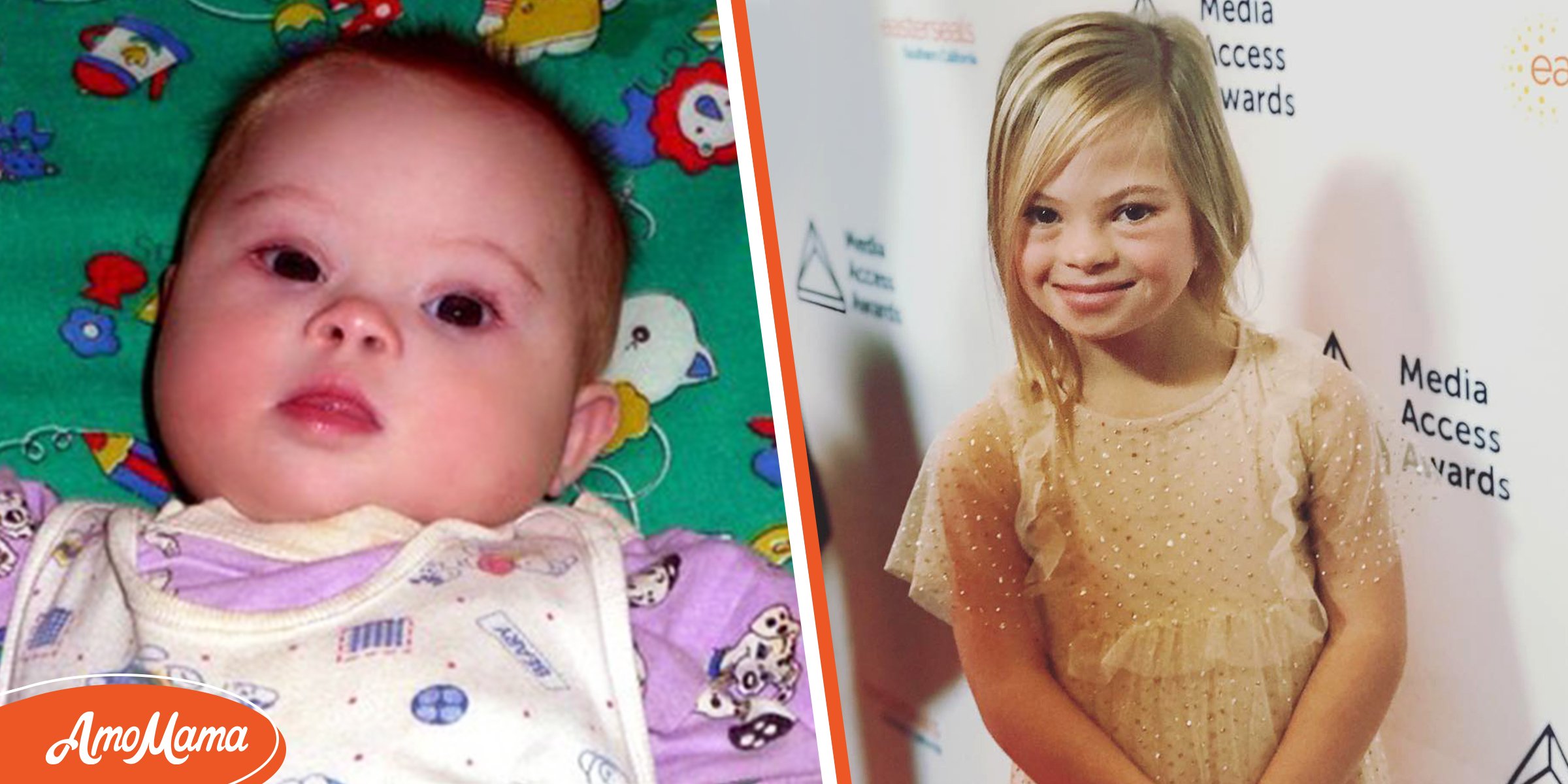 baby-with-down-syndrome-abandoned-at-birth-becomes-an-actress-years-later