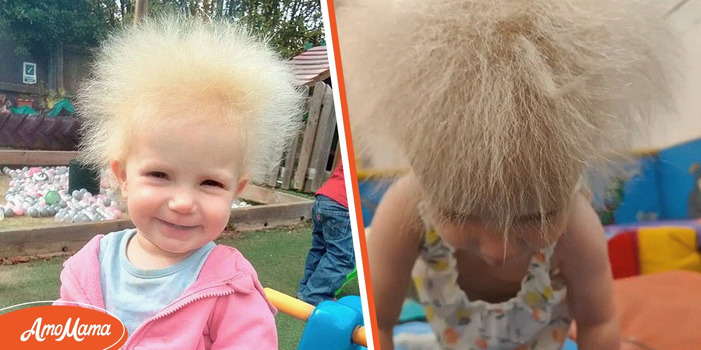 Baby Born with Hair Condition That Makes Her Unique Is One of 'Only 100  People' in the World with It
