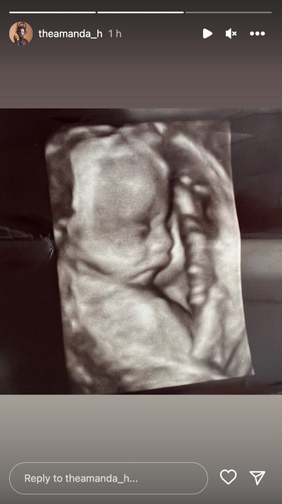 Steve Harvey's 8th Grandchild on scan | Source: instagram.com/theamanda_h