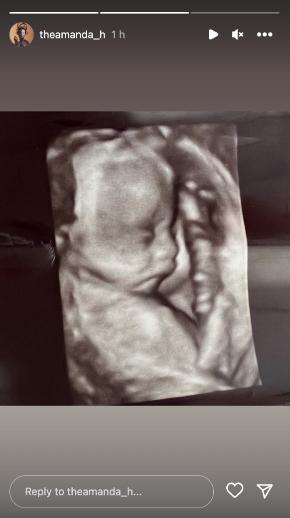 Steve Harvey's 8th grandchild's scan | Source: instagram.com/theamanda_h