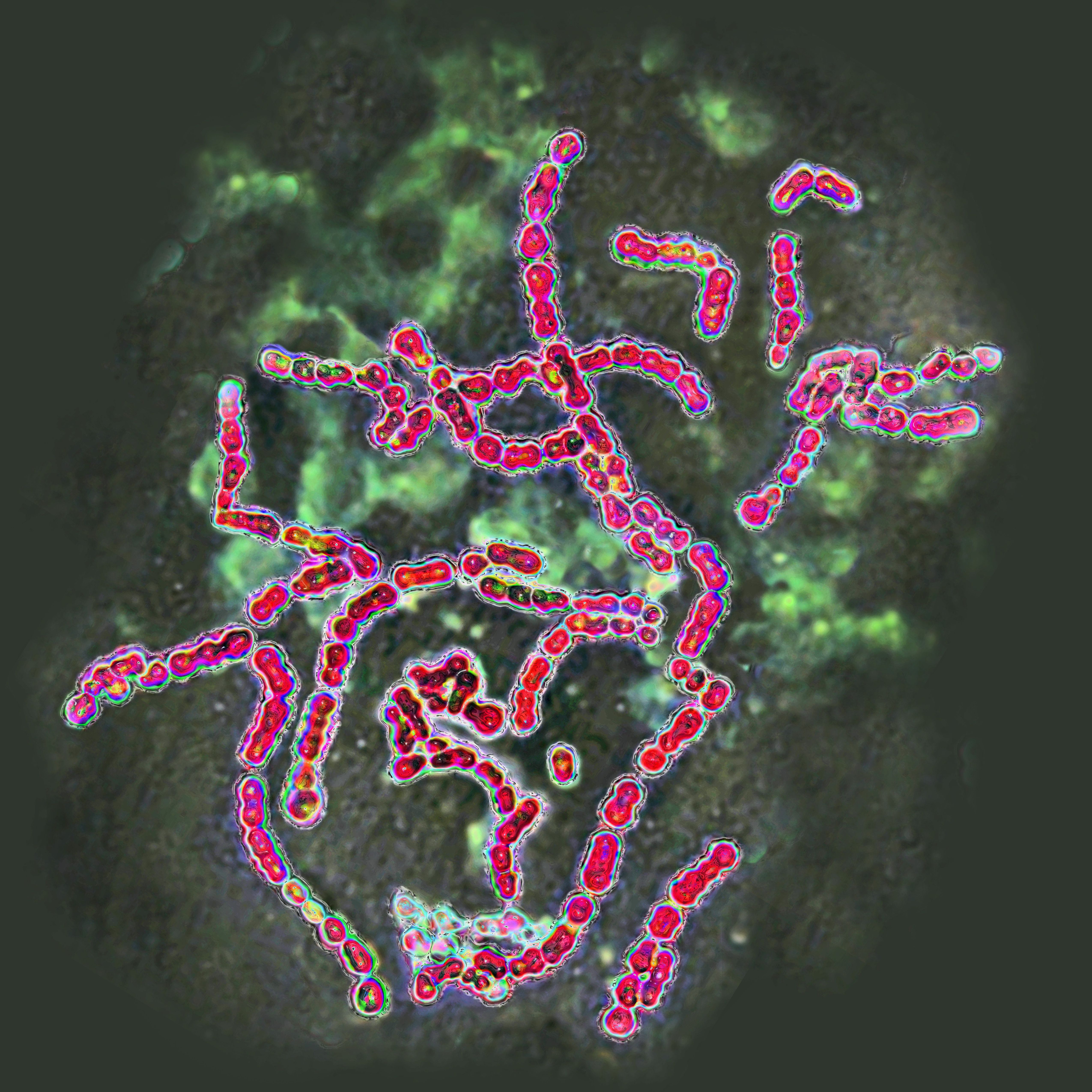 Optical microscopy image of group A Streptococcus pyogenes | Source: Getty Images