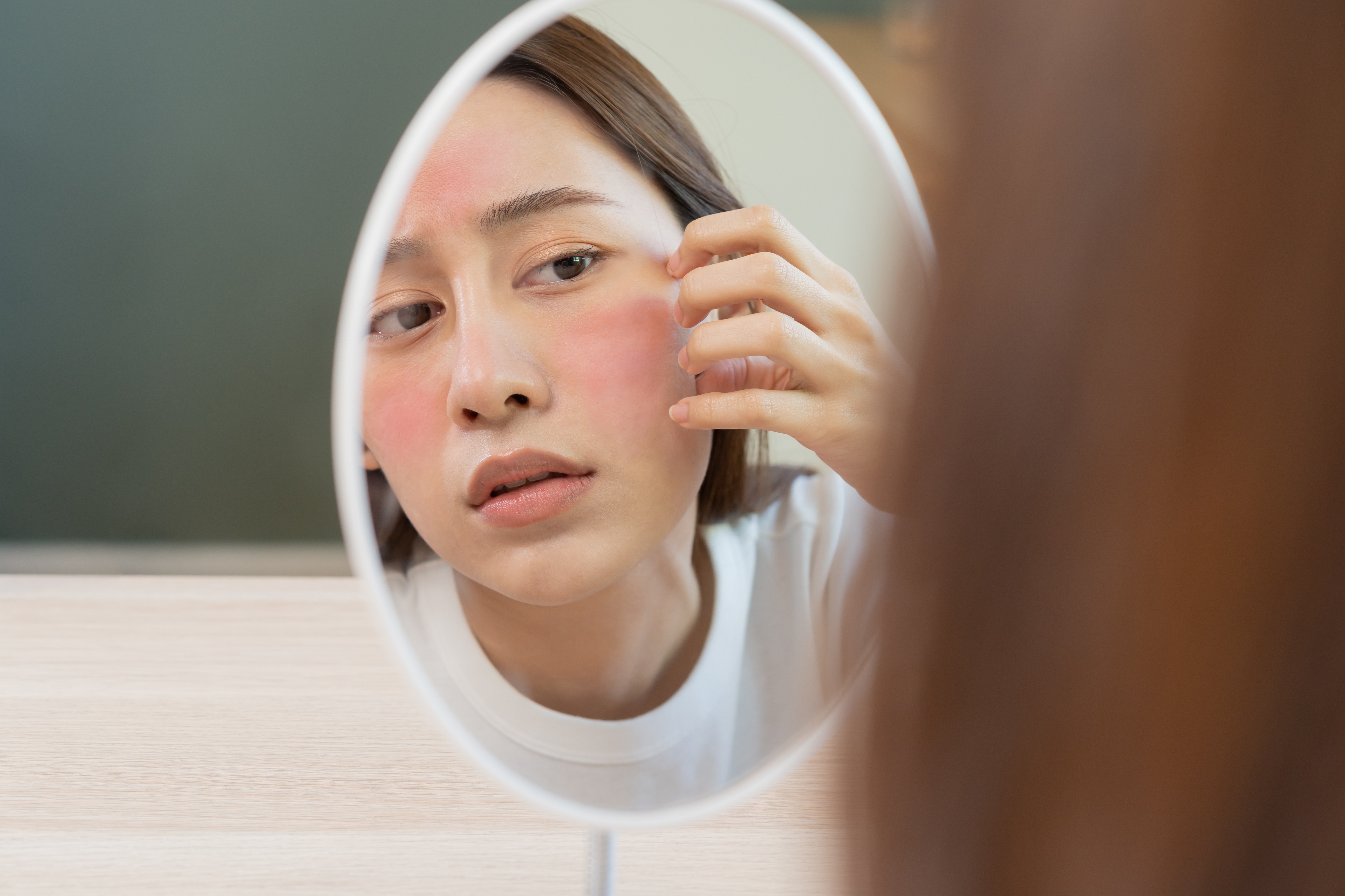 A woman with rashes looks at the mirror. | Source: Shutterstock
