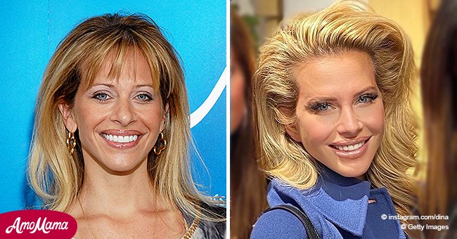 Dina Manzo From Real Housewives Of New Jersey Admits To Getting A Nose Job