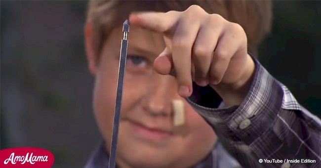 10-year-old boy pierced his head with a meat skewer while playing with friends