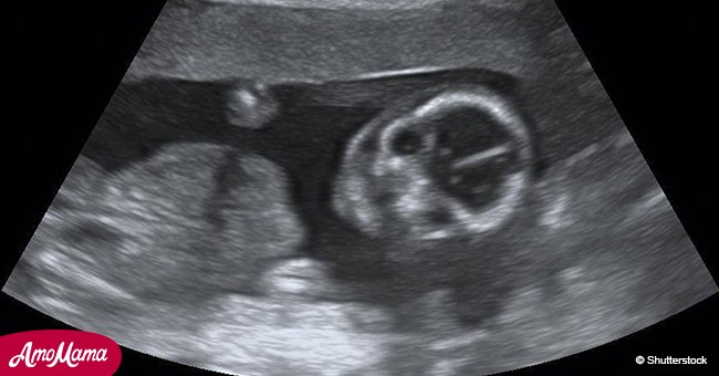 Doctors told mom twice that unborn baby was dead but she proved them wrong