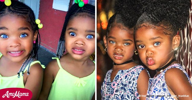 Girls who were called the most beautiful twins in the world are all grown up 