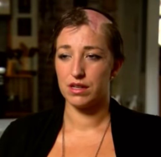 Alon Abare quedó sin cabello y le echó la culpa a su auto. | Foto: YouTube/Inside Edition Alon Abare quedó sin cabello y le echó la culpa a su auto. | Foto: YouTube/Inside Edition