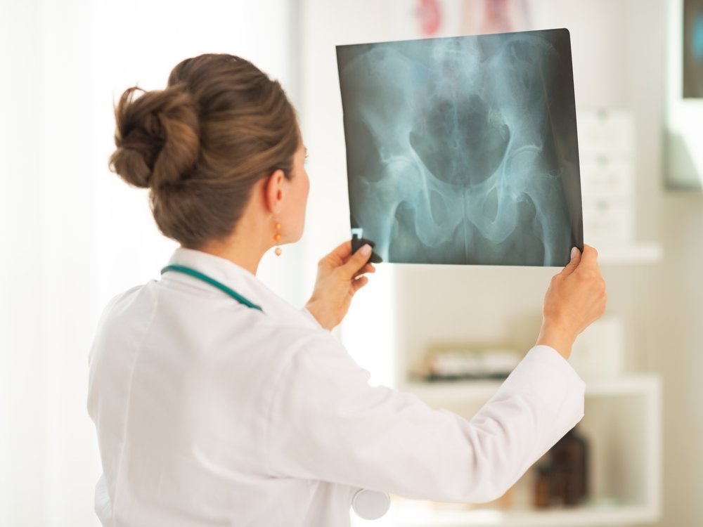Mujer doctora mirandola tomografía. Fuente: Shutterstock