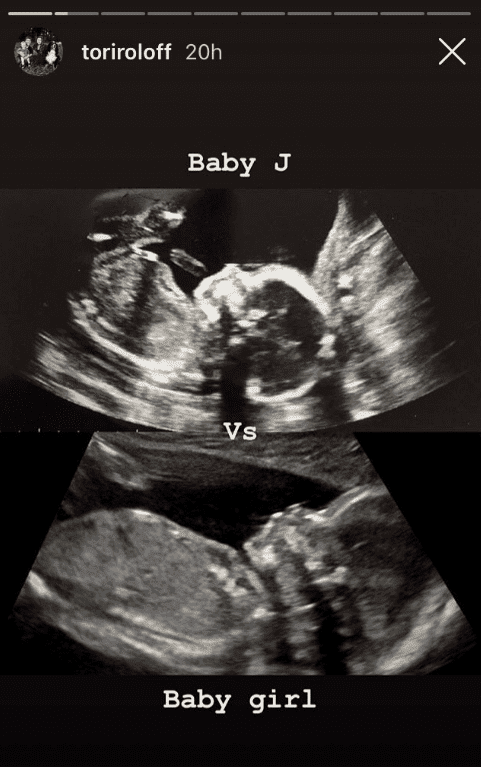 Ultrasound of Jackson and expected baby girl | Photo: Instagram Story/Tori Roloff