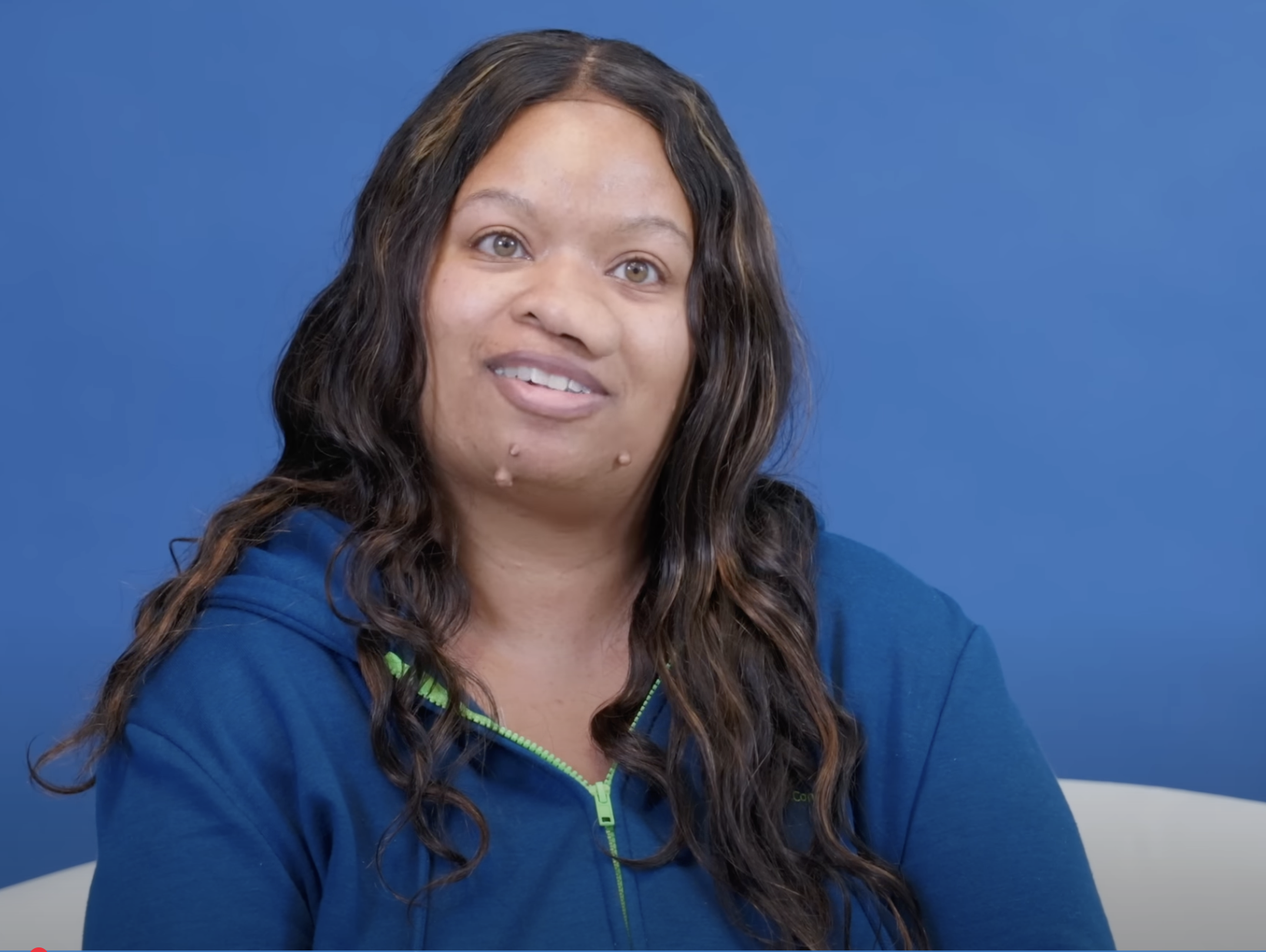 Danielle face before surgery, dated August 2, 2024 | Source: YouTube/@Dr.Truesdale