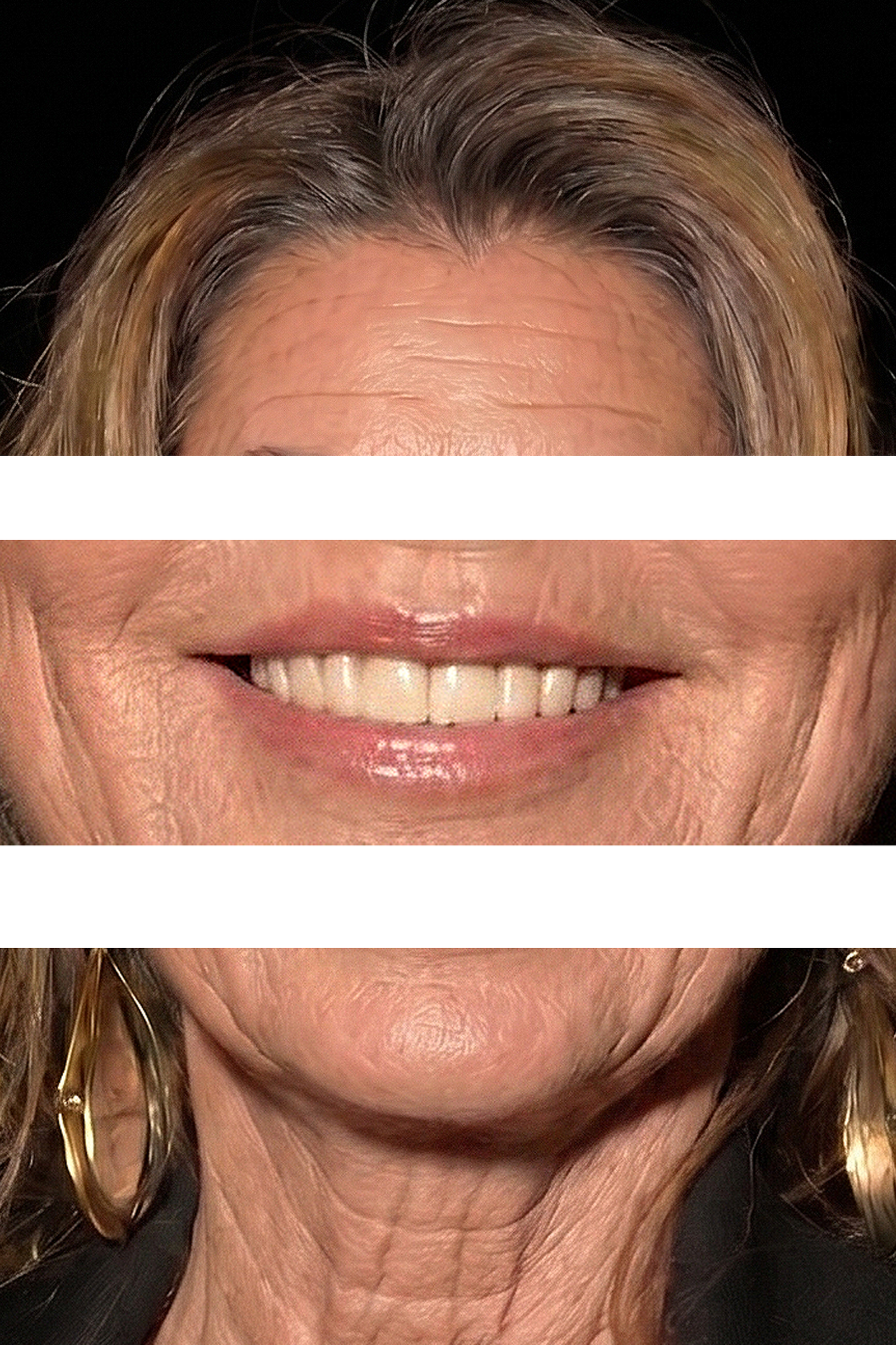 This AI-generated triptych provides an up-close analytical look at simulated aging details on Shania Twain, isolating forehead creases, perioral lip lines, and natural neck texture. | Source: Gemini