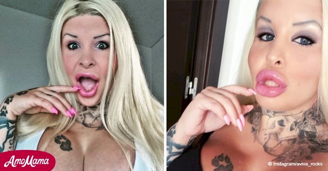 Woman spends more than $50,000 to 'look more plastic,' and now she wants her ribs removed