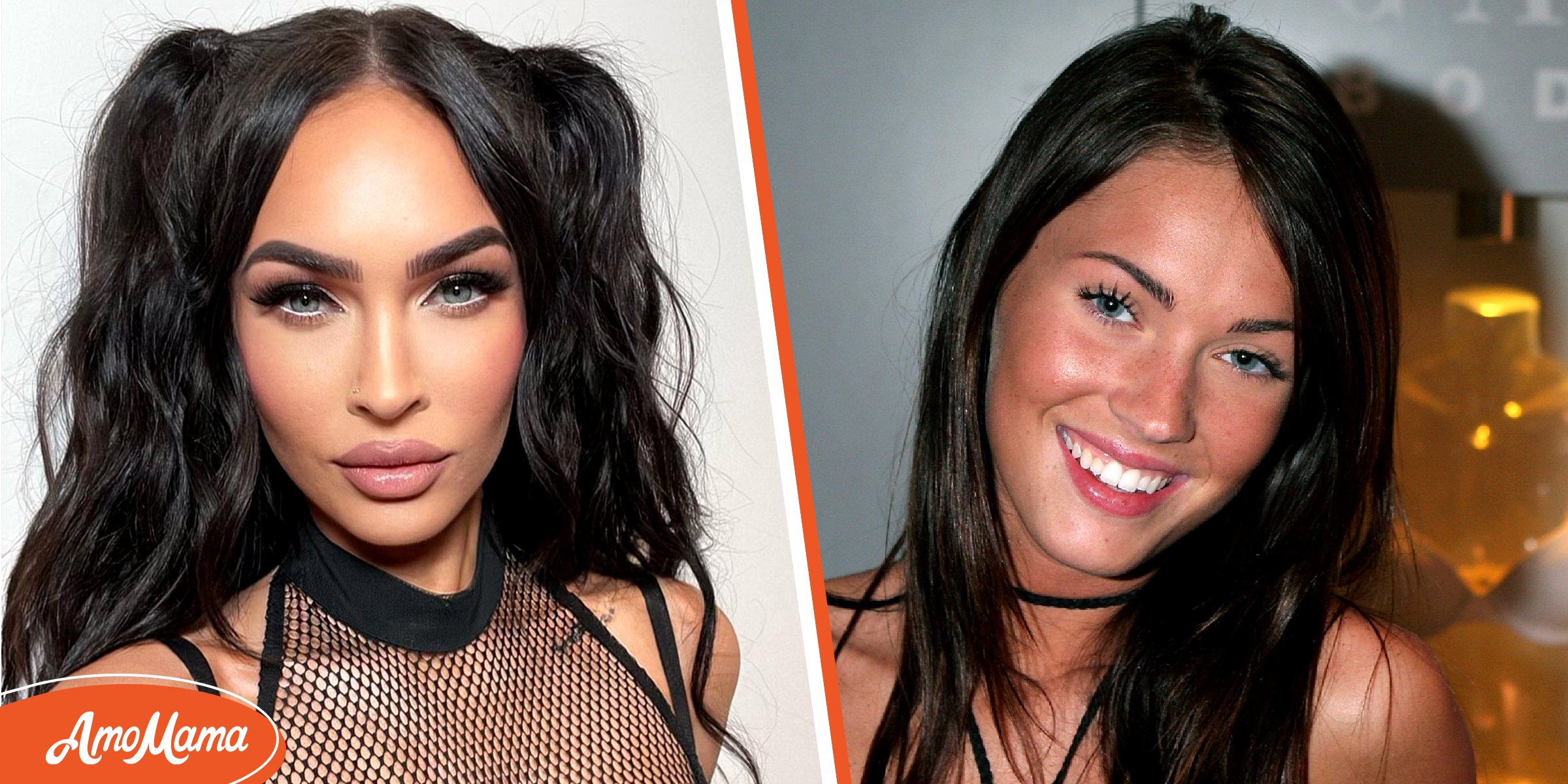 Did Megan Fox Ever Have Plastic Surgery Done? Experts Weigh In