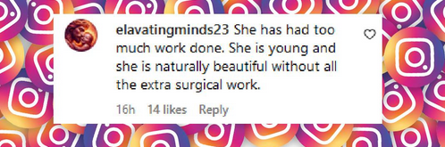 A fan comments on Eva Mendes's facial appearance on "The Tonight Show Starring Jimmy Fallon," as she promoted her new children's book, from an Instagram video, dated September 19, 2024 | Source: Instagram/pagesix/