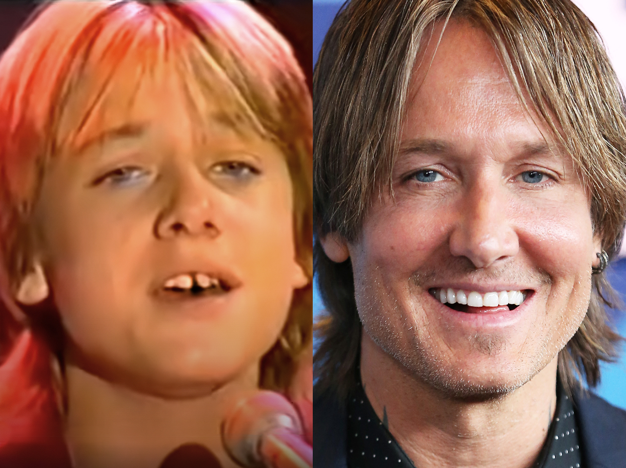 A before and after of Keith Urban's smile. | Source: YouTube/Nine | Getty Images