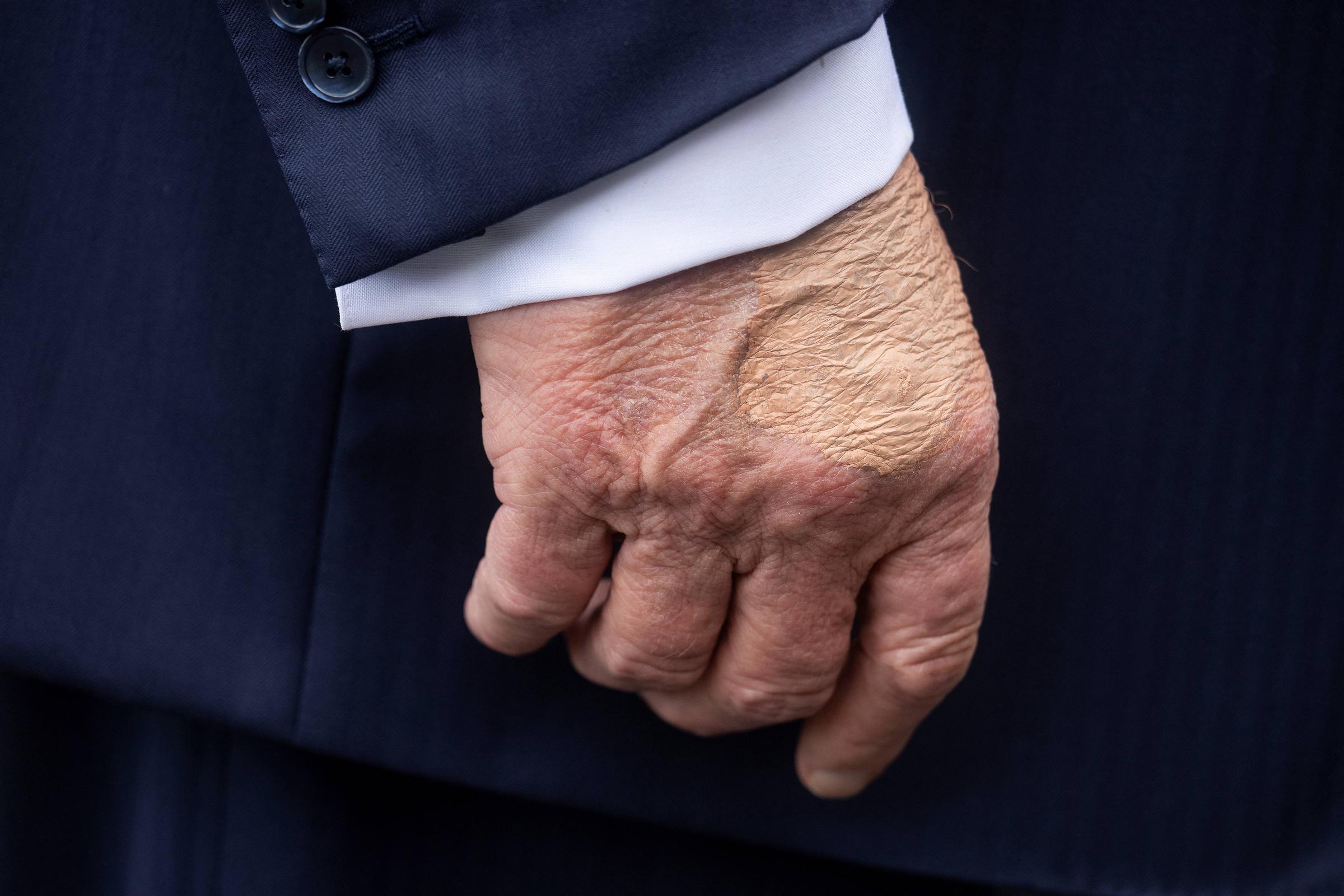 Donald Trump's right hand before he boarded Marine One on the South Lawn of the White House on July 15, 2025, in Washington, D.C. | Source: Getty Images