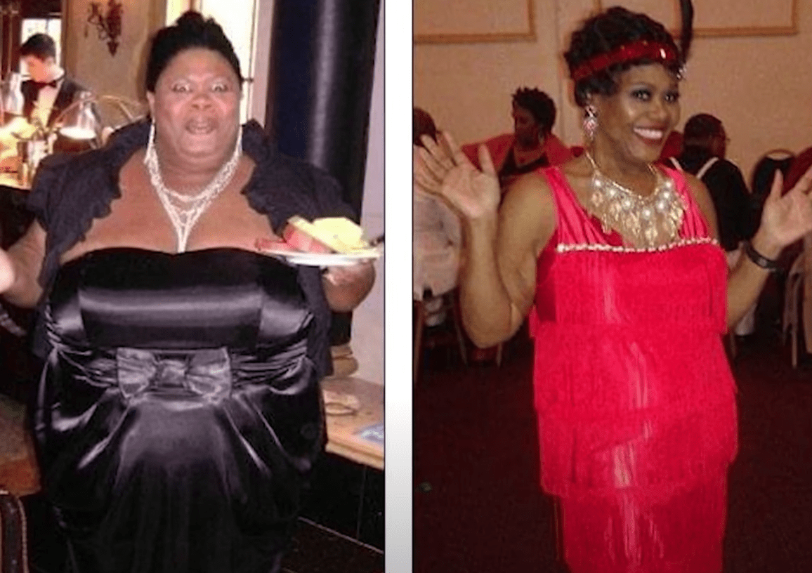 Before and after photos of a woman who has lost over a hundred pounds | Photo: Youtube/TODAY 