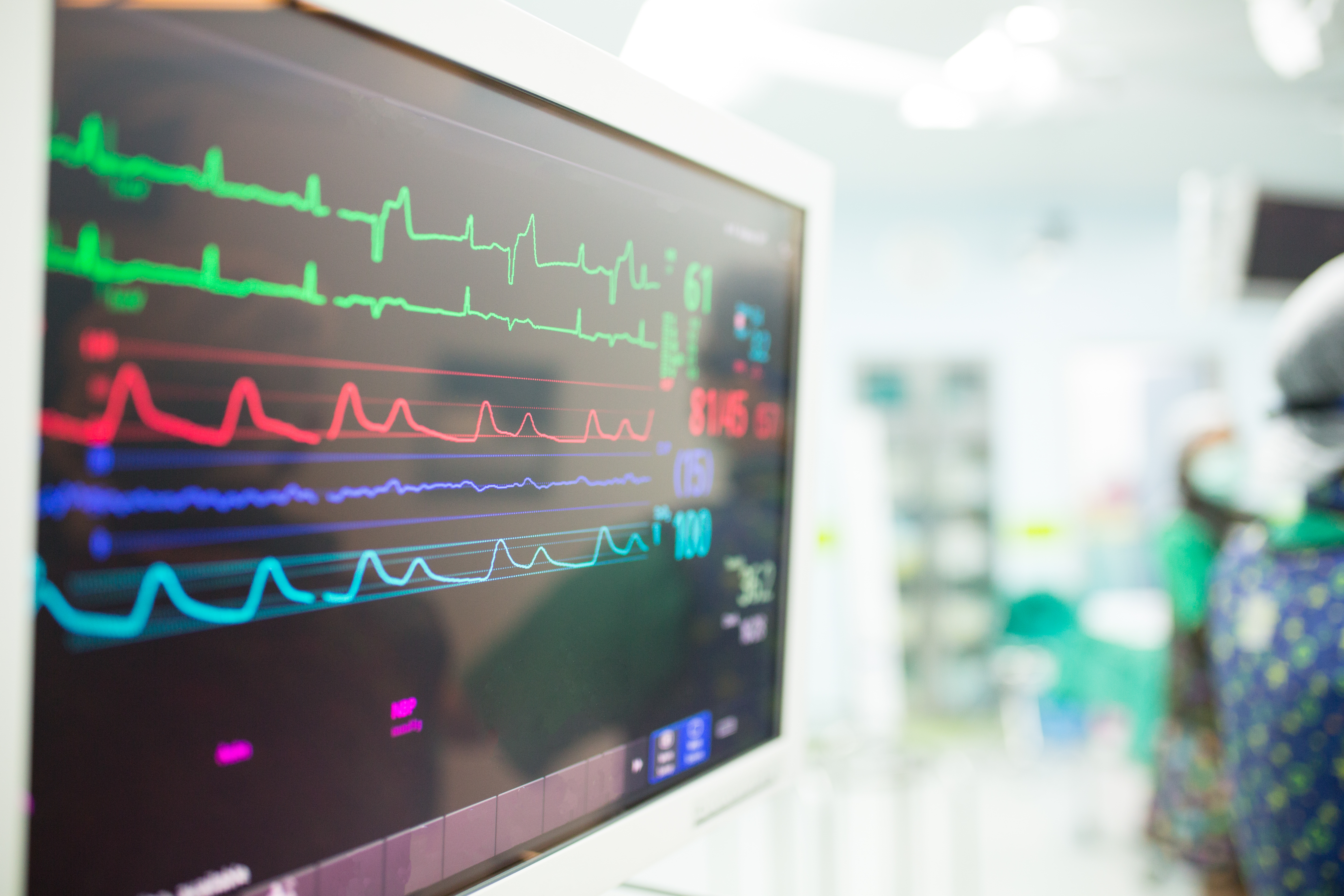 Monitor heart rate for surgery in operate room | Source: Shutterstock