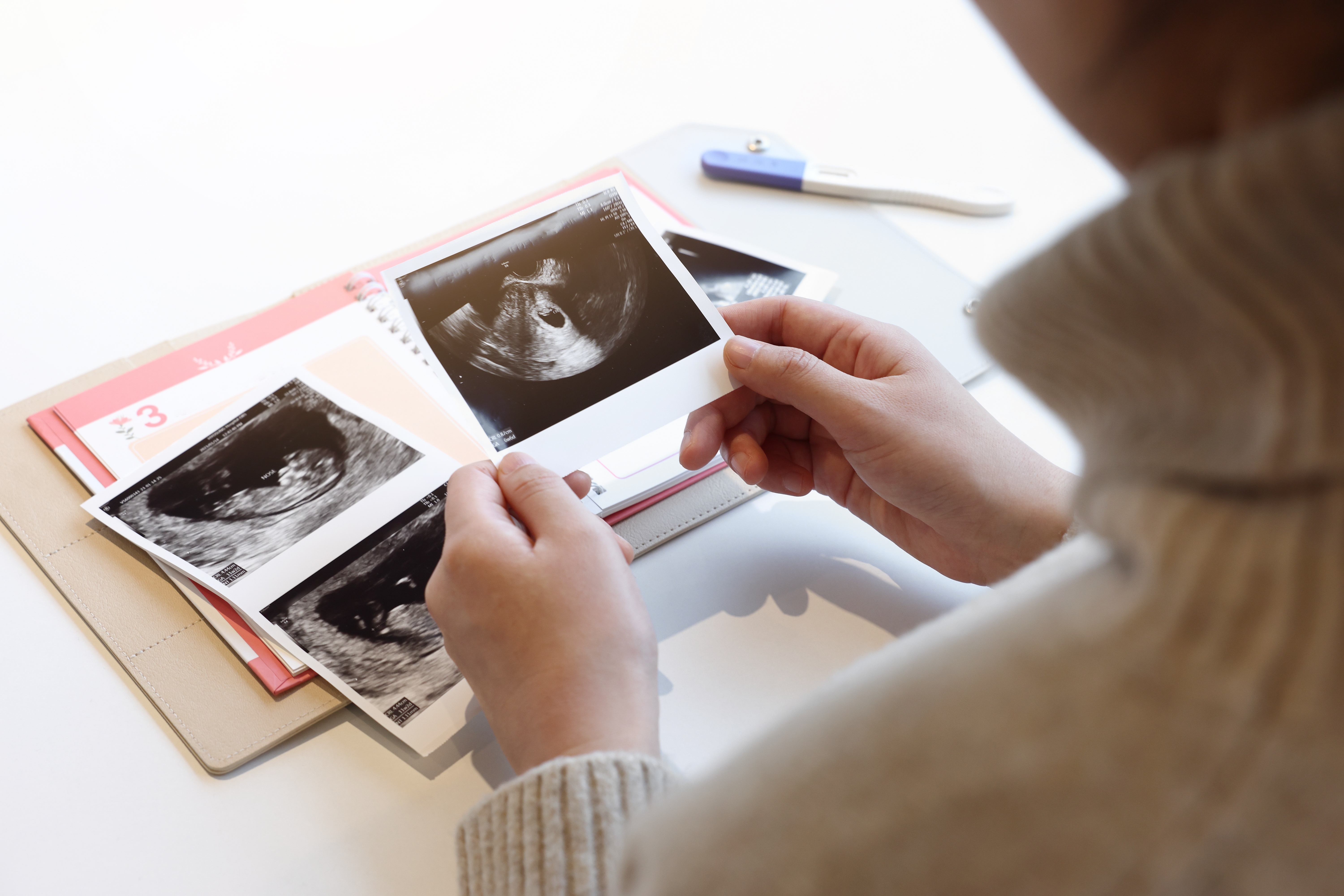A pregnant woman | Source: Shutterstock