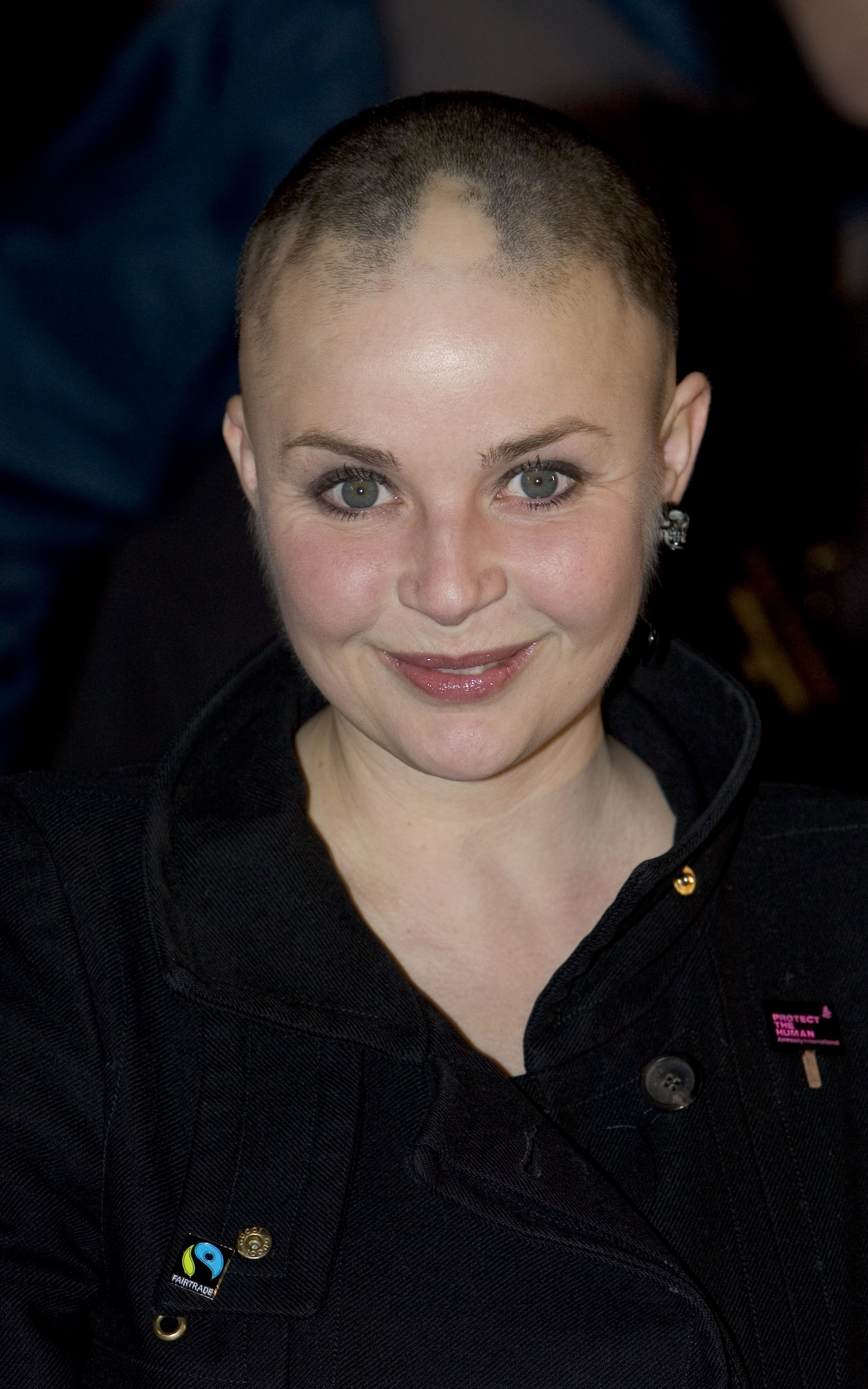 Large patches of bare scalp are visible across the top and sides of Porter's head, with only sparse, short growth remaining. She wears a black jacket bearing a Fairtrade badge and an Amnesty International "Protect the Human" pin, her expression warm and composed. Pictured at the UK premiere of "Blood Diamond" at the Odeon Leicester Square, London, January 2007.