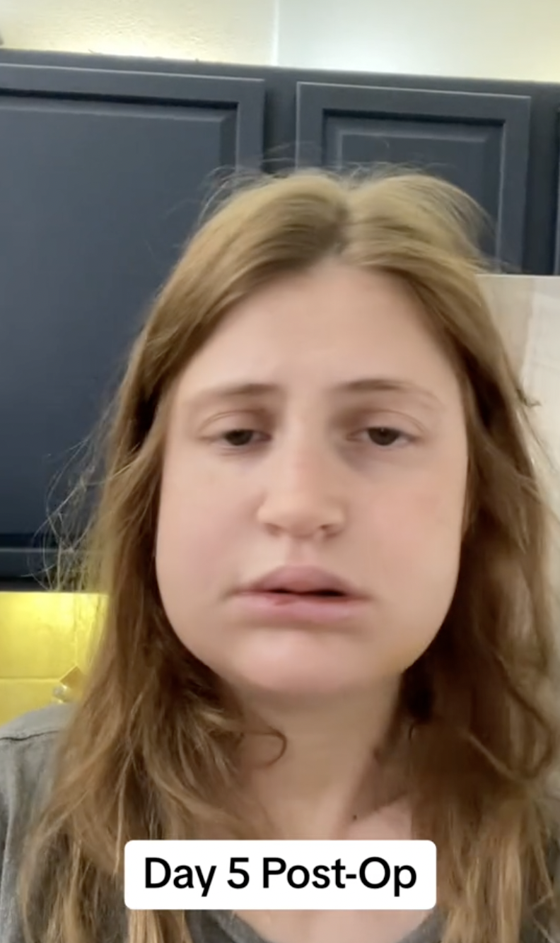 Virginia Elder stands in her kitchen on Day 5 post-op, marking early mobility. | Source: TikTok/virginiaeelder