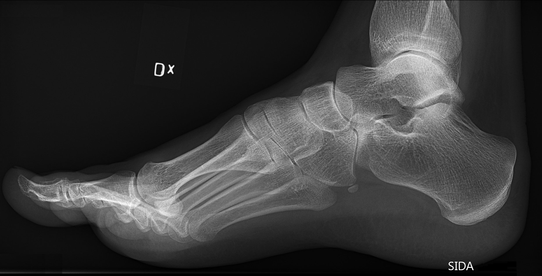 Scan eines Fußes | Quelle: Wikimedia Commons